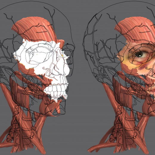 Realistic study of a black eye in relation to muscle tissue